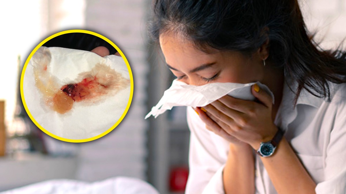 blood in mucus causes symptoms